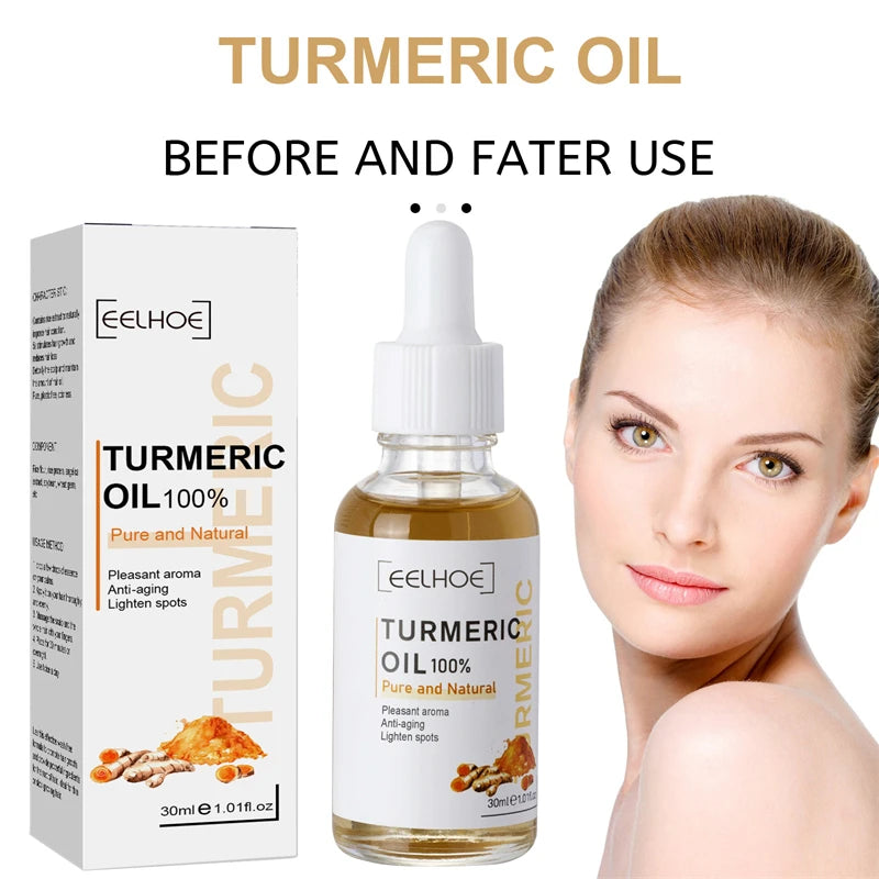 Turmeric Face Serum – Shrink Pores & Fade Dark Spots | Brightening, Moisturizing Curcumin Essence