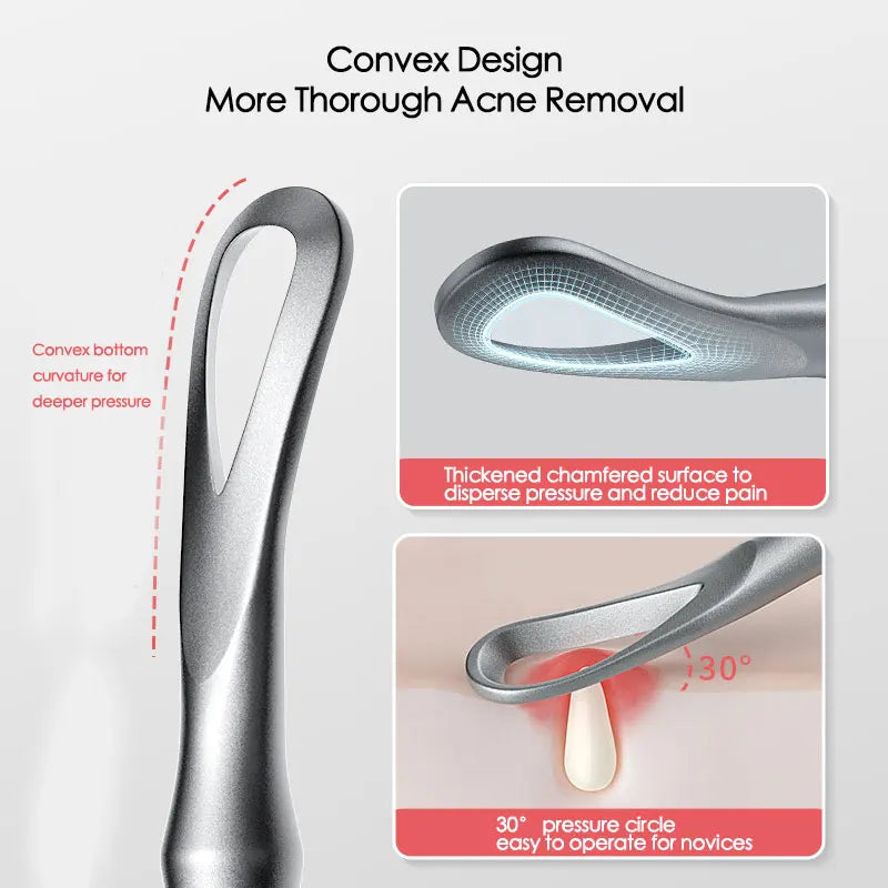 Blackhead Remover Tool – Precise Acne Extractor Tweezers for Deep Pore Cleaning