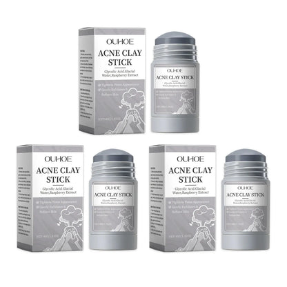 Pore Cleansing Clay Mask - Shrinks Pores, Hydrating, Exfoliating, Oil Control, Acne Treatment - Beauty & Beyond