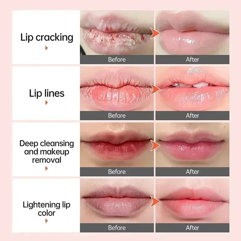 Dark Lip Balm - Fast Lightening, Pink Lip Exfoliating, Fade Lip Lines, Moisturizer - Beauty & Beyond