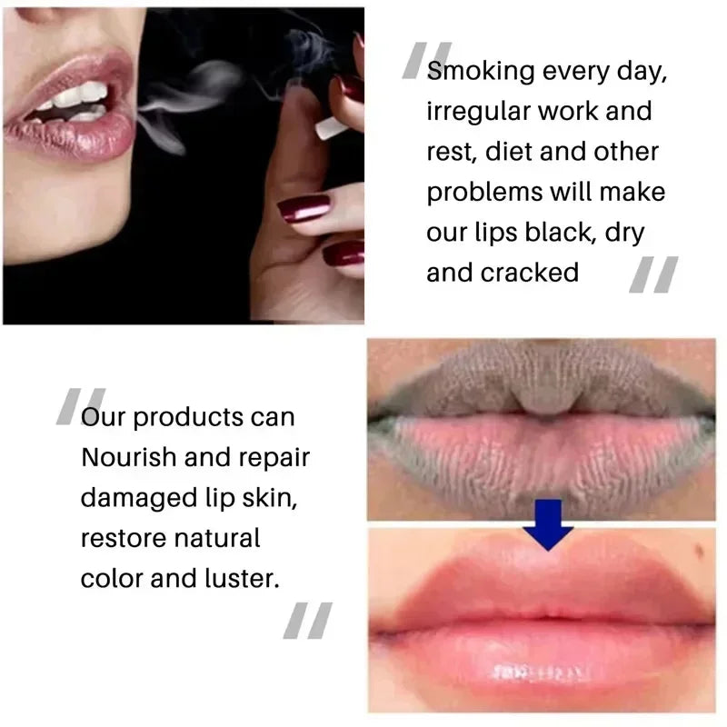 Dark Lip Balm - Fast Lightening, Pink Lip Exfoliating, Fade Lip Lines, Moisturizer - Beauty & Beyond