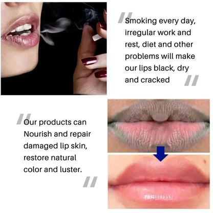 Dark Lip Balm - Fast Lightening, Pink Lip Exfoliating, Fade Lip Lines, Moisturizer - Beauty & Beyond
