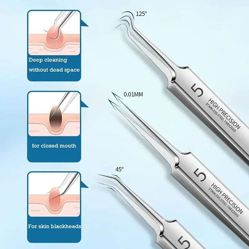 German Ultra-Fine No. 5 Blackhead & Pimple Remover - Acne Needle Tool, Beauty Tweezers - Beauty & Beyond