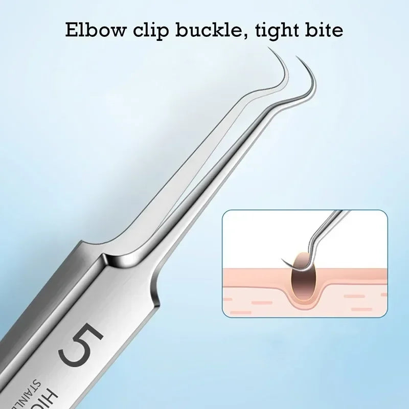 German Ultra-Fine No. 5 Blackhead & Pimple Remover - Acne Needle Tool, Beauty Tweezers - Beauty & Beyond