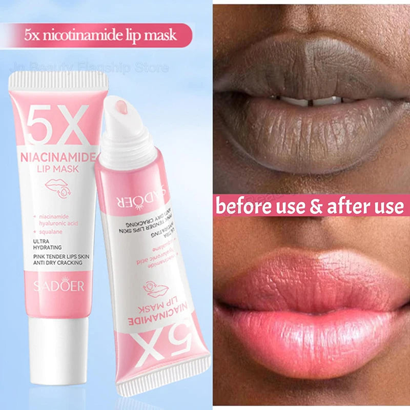 Dark Lip Balm - Lightening, Melanin Removal, Exfoliating, Pink Lip Treatment, Moisturizing - Beauty & Beyond