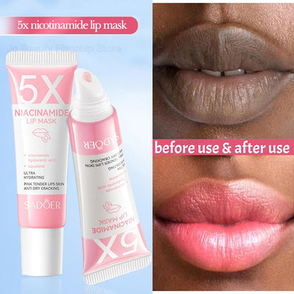 Dark Lip Balm - Lightening, Melanin Removal, Exfoliating, Pink Lip Treatment, Moisturizing - Beauty & Beyond