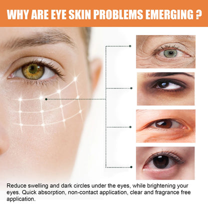Vitamin C Eye Balm - Moisturizing, Dark Circles, Puffiness, Fine Lines, Brightening Stick - Beauty & Beyond