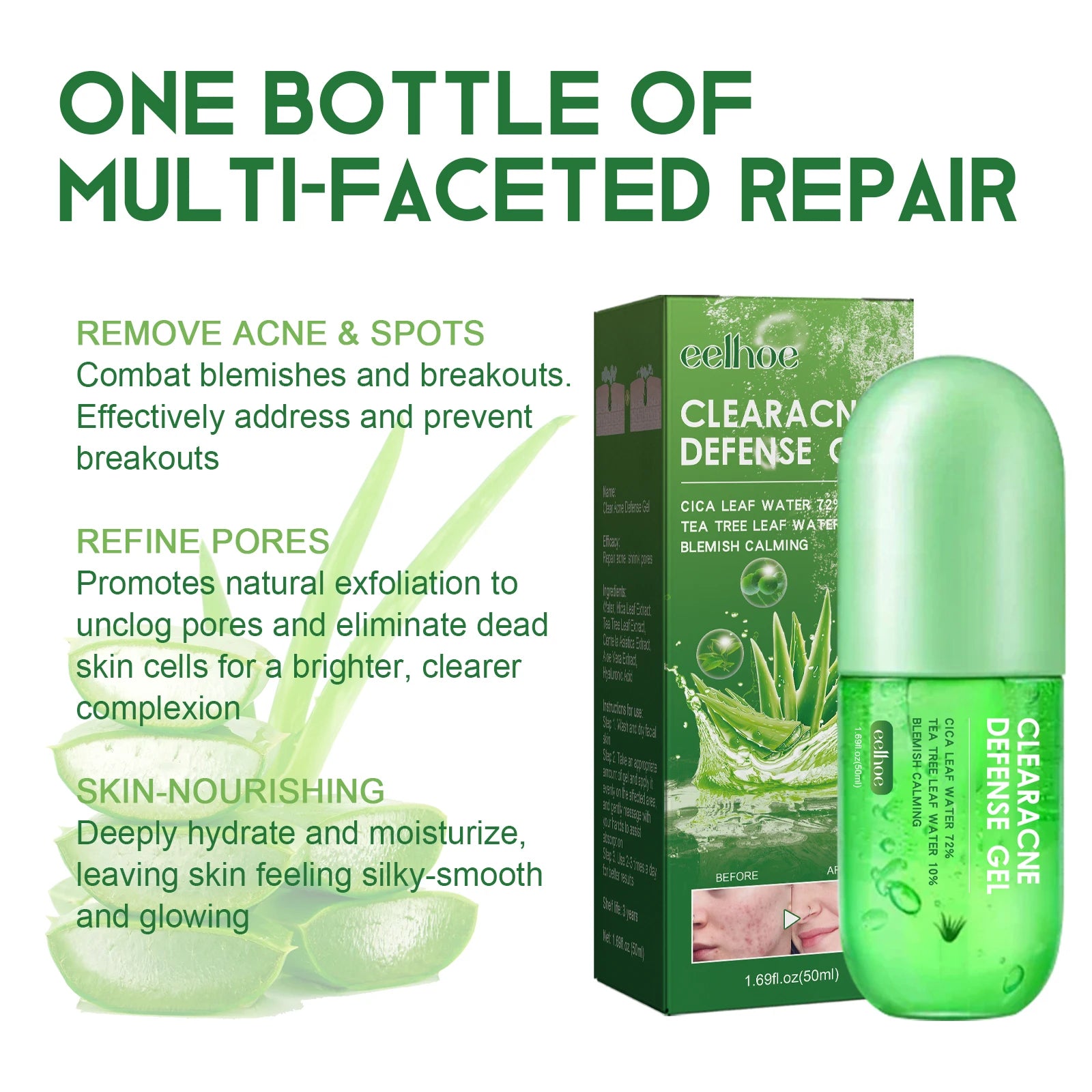 50ml Acne Repair Gel – Exfoliating, Oil Control & Pore Minimizing Face Care - Beauty & Beyond