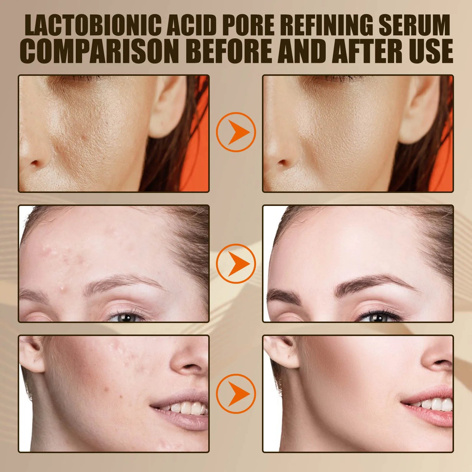 Lactic Acid Pore Shrink Serum - Moisturizing, Blackhead Removal, Firming, Brightening Essence - Beauty & Beyond