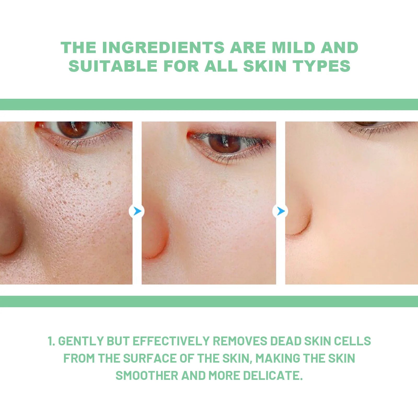 Face Exfoliating Cream - Dead Skin Remover, Whitening, Pore Exfoliator, Brightening Gel - Beauty & Beyond