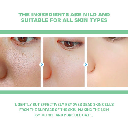Face Exfoliating Cream - Dead Skin Remover, Whitening, Pore Exfoliator, Brightening Gel - Beauty & Beyond