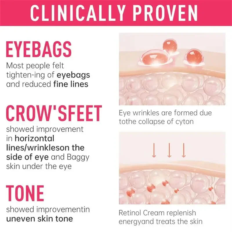 Instant Eye Bag Remover Cream – Retinol, Anti-Wrinkle, Firming & Brightening Eye Care - Beauty & Beyond
