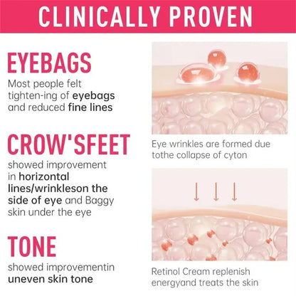 Instant Eye Bag Remover Cream – Retinol, Anti-Wrinkle, Firming & Brightening Eye Care - Beauty & Beyond