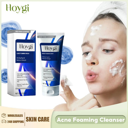 Facial Cleanser - Anti-Acne, Oil Control, Blackhead Remover, Pore Shrinking, 100g - Beauty & Beyond