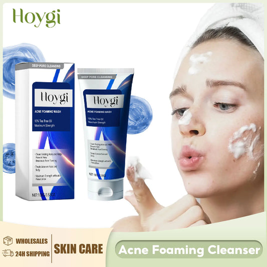 Facial Cleanser - Anti-Acne, Oil Control, Blackhead Remover, Pore Shrinking, 100g - Beauty & Beyond