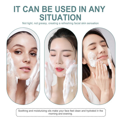 Facial Cleanser - Anti-Acne, Oil Control, Blackhead Remover, Pore Shrinking, 100g - Beauty & Beyond