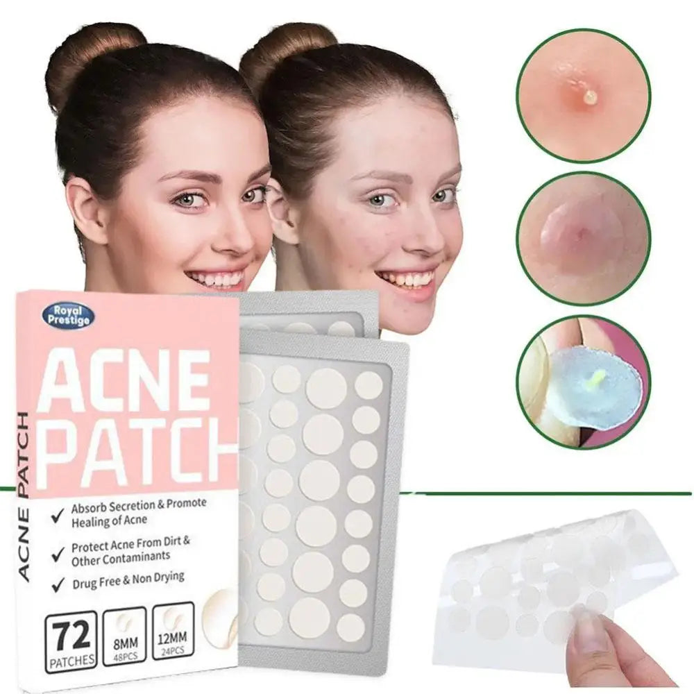 72PCS Invisible Acne Patches - Hydrocolloid, Pimple & Spot Concealer, Waterproof Repair Sticker - Beauty & Beyond