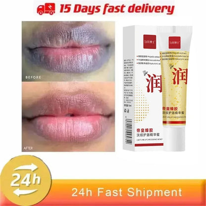 Dark Lip Balm - Fast Lightening, Pink Lip Exfoliating, Fade Lip Lines, Moisturizer - Beauty & Beyond