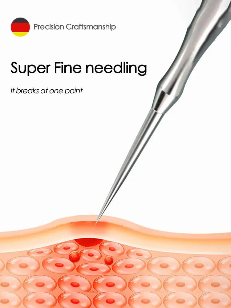 Blackhead Remover Acne Tool - Pimple Extractor, Tweezers, Pore Cleaner - Beauty & Beyond
