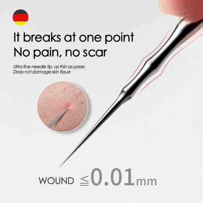 Blackhead Remover Tool – Precise Acne Extractor Tweezers for Deep Pore Cleaning