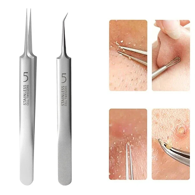 German Ultra-Fine No. 5 Blackhead & Pimple Remover - Acne Needle Tool, Beauty Tweezers - Beauty & Beyond