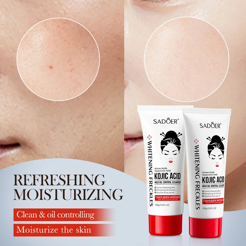 Kojic Acid Facial Wash - Oil Control, Deep Cleaning, Moisturizing, Non-Irritating Cleanser - Beauty & Beyond