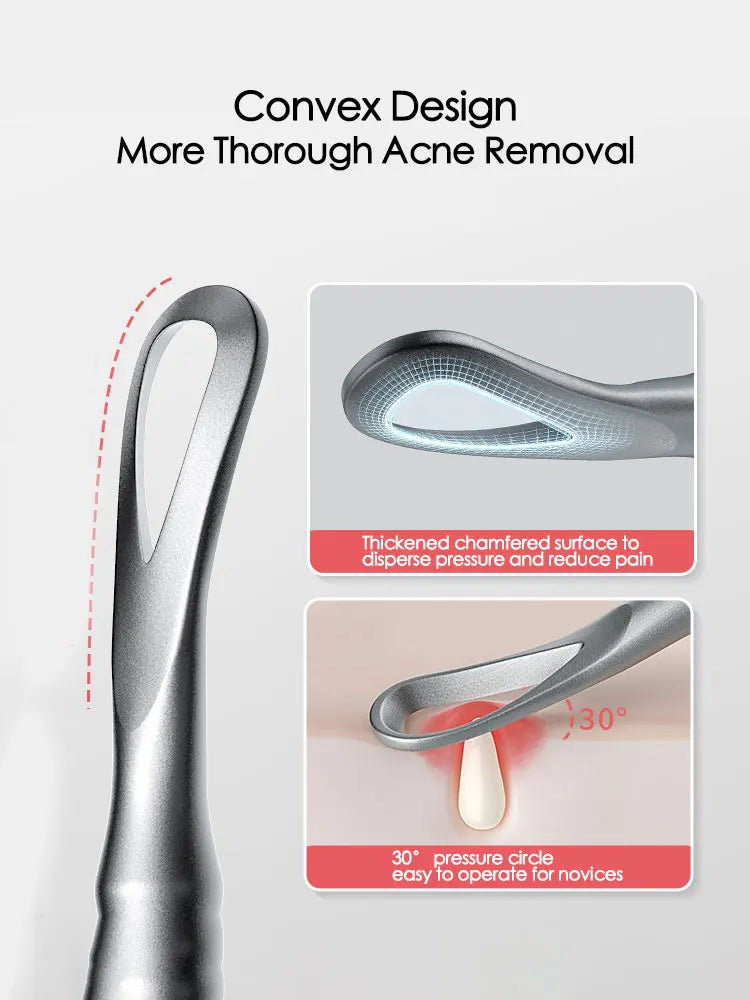 Blackhead Remover Acne Tool - Pimple Extractor, Tweezers, Pore Cleaner - Beauty & Beyond