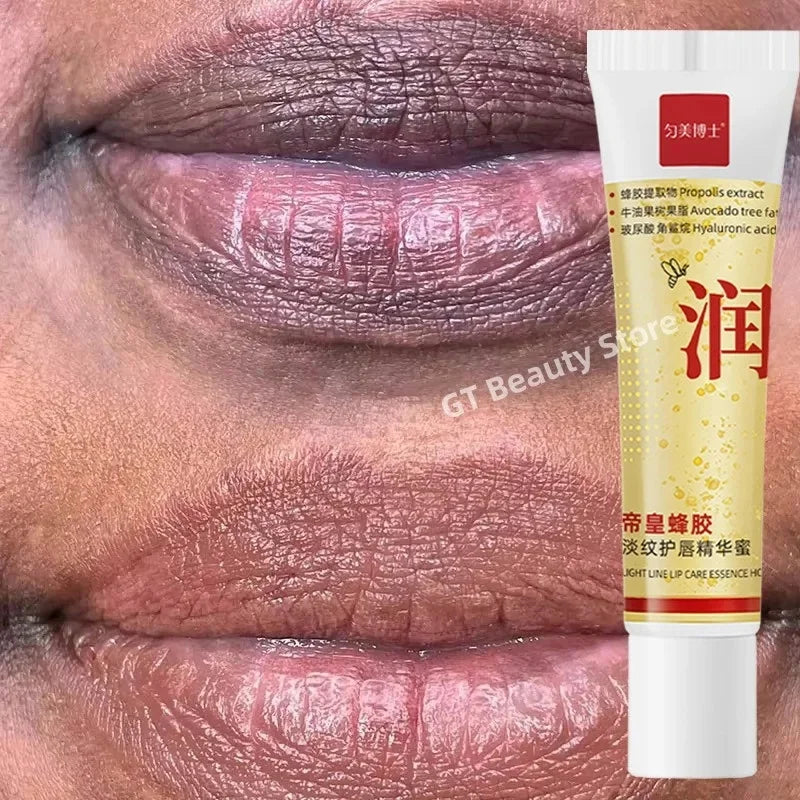 Dark Lip Balm - Fast Lightening, Pink Lip Exfoliating, Fade Lip Lines, Moisturizer - Beauty & Beyond