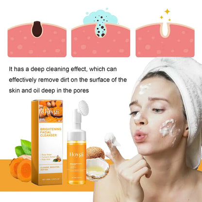 Turmeric Cleanser - Anti-Acne, Oil Control, Blackhead Remover, Brightening Foam Face Wash - Beauty & Beyond