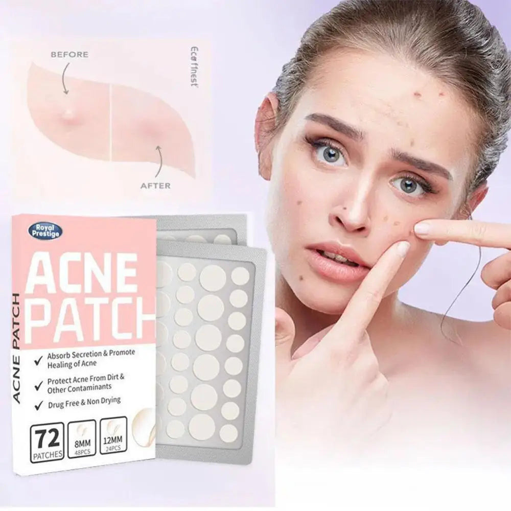 72PCS Invisible Acne Patches - Hydrocolloid, Pimple & Spot Concealer, Waterproof Repair Sticker - Beauty & Beyond