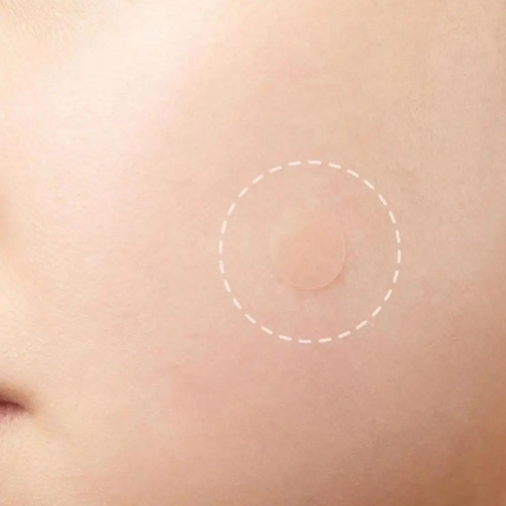 72PCS Invisible Acne Patches - Hydrocolloid, Pimple & Spot Concealer, Waterproof Repair Sticker - Beauty & Beyond