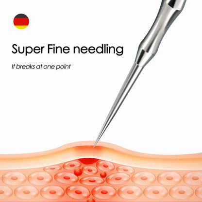 Blackhead Remover Tool – Precise Acne Extractor Tweezers for Deep Pore Cleaning