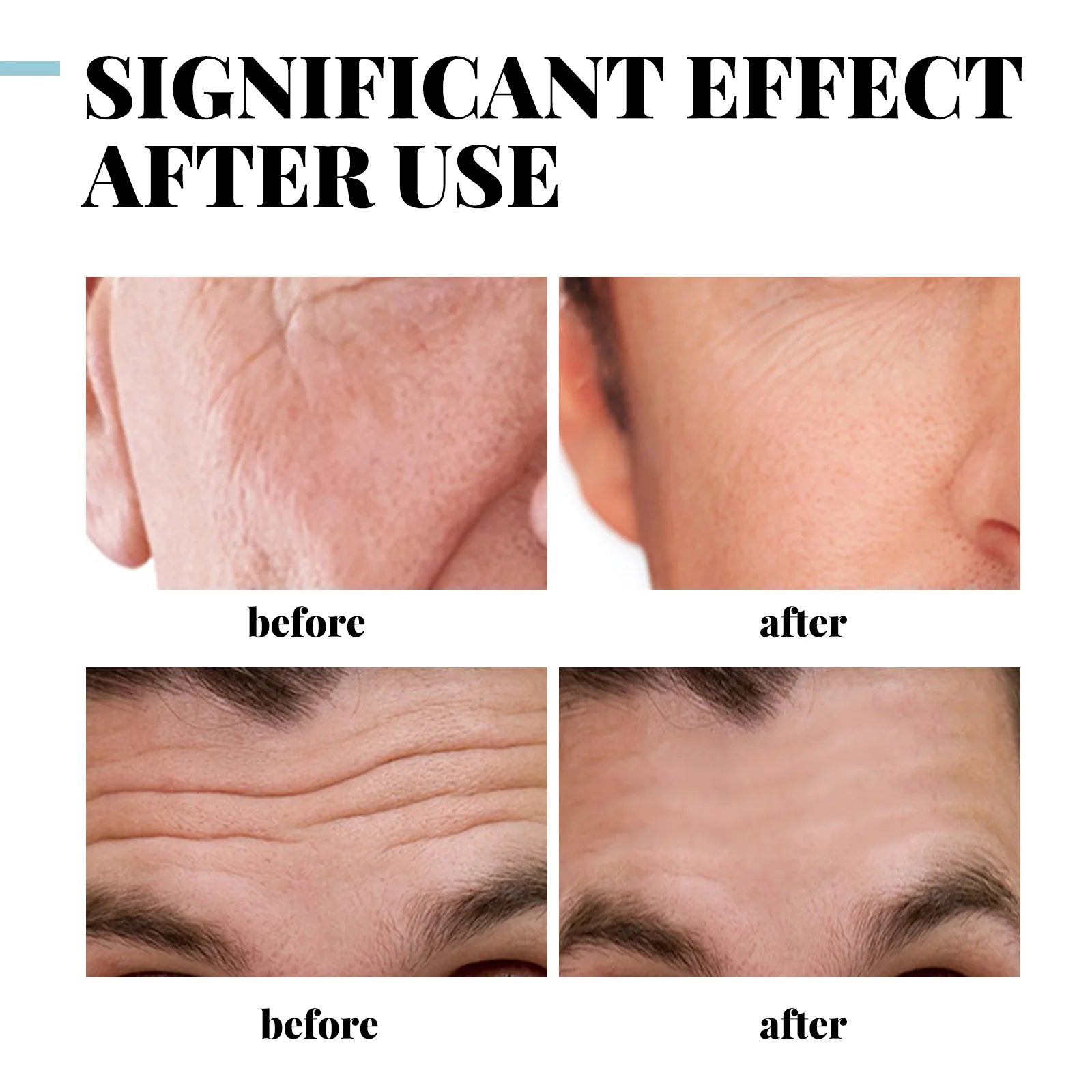 Men's Collagen Face Cream - Anti-Wrinkle, Firming, Moisturizing, Hyaluronic Acid, Whitening Care - Beauty & Beyond