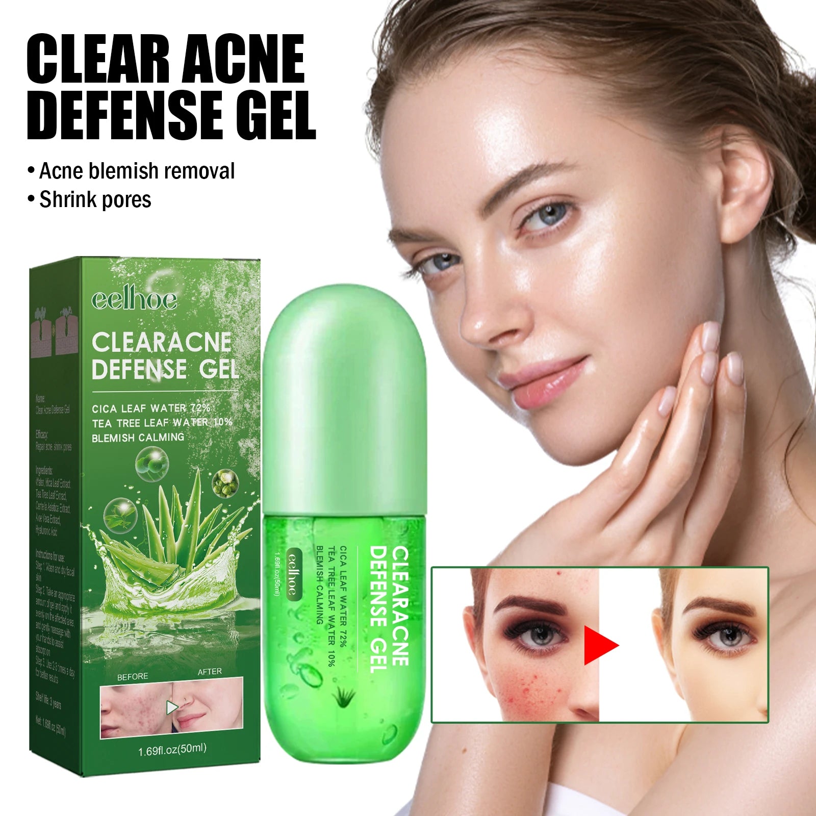 50ml Acne Repair Gel – Exfoliating, Oil Control & Pore Minimizing Face Care - Beauty & Beyond