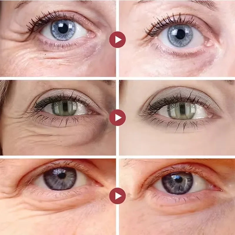 Instant Eye Bag Remover Cream – Retinol, Anti-Wrinkle, Firming & Brightening Eye Care - Beauty & Beyond