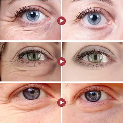 Instant Eye Bag Remover Cream – Retinol, Anti-Wrinkle, Firming & Brightening Eye Care - Beauty & Beyond