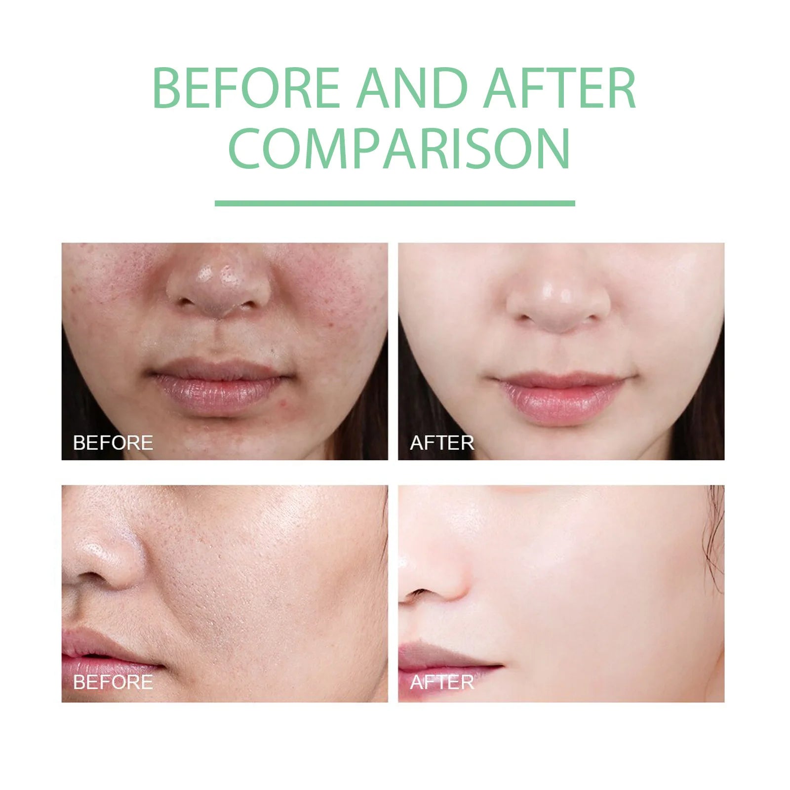Face Exfoliating Cream - Dead Skin Remover, Whitening, Pore Exfoliator, Brightening Gel - Beauty & Beyond
