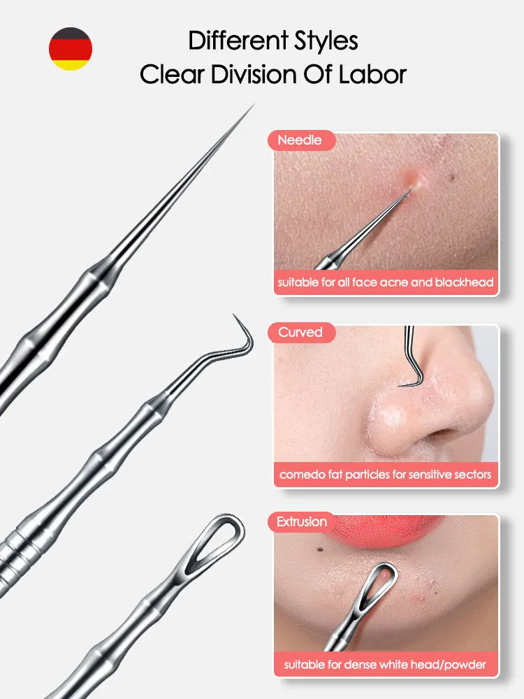 Blackhead Remover Acne Tool - Pimple Extractor, Tweezers, Pore Cleaner - Beauty & Beyond