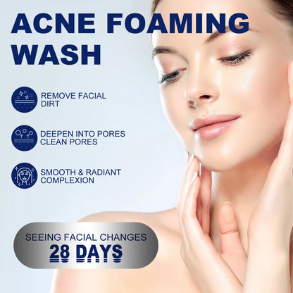 Facial Cleanser - Anti-Acne, Oil Control, Blackhead Remover, Pore Shrinking, 100g - Beauty & Beyond