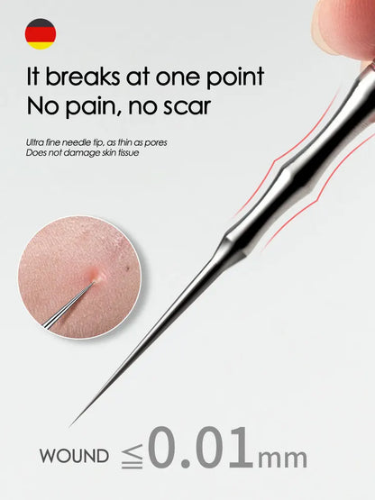 Blackhead Remover Acne Tool - Pimple Extractor, Tweezers, Pore Cleaner - Beauty & Beyond