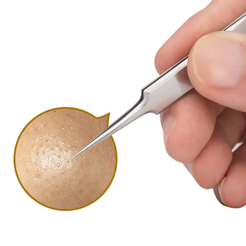 German Ultra-Fine No. 5 Blackhead & Pimple Remover - Acne Needle Tool, Beauty Tweezers - Beauty & Beyond