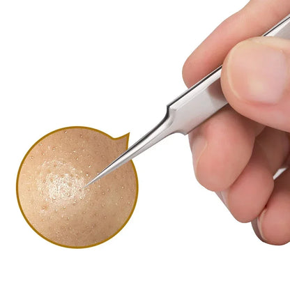 German Ultra-Fine No. 5 Blackhead & Pimple Remover - Acne Needle Tool, Beauty Tweezers - Beauty & Beyond