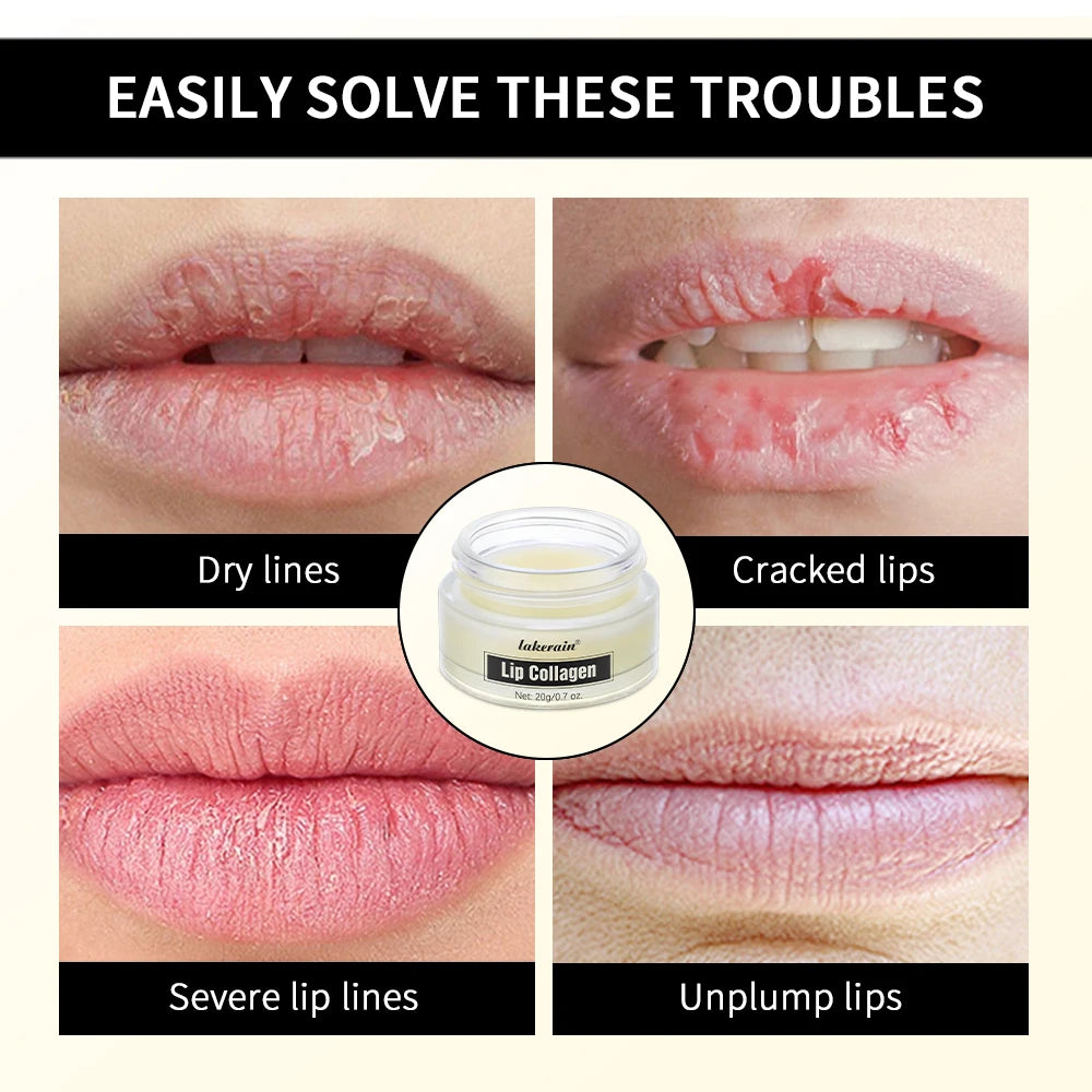 Collagen Lip Balm Mask – Lighten Melanin & Exfoliate | Fade Lip Lines, Brighten & Repair