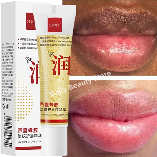 Dark Lip Balm - Fast Lightening, Pink Lip Exfoliating, Fade Lip Lines, Moisturizer - Beauty & Beyond